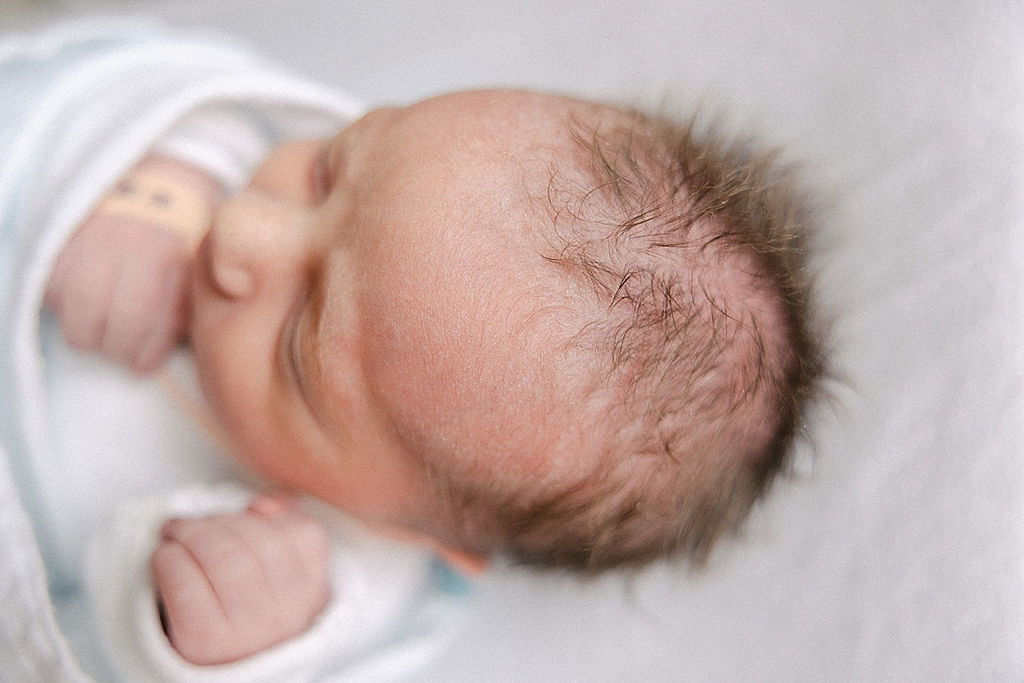 Details of a newborn baby’s head carmel pediatricians